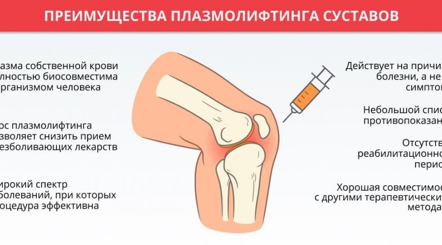 Плазмолифтинг